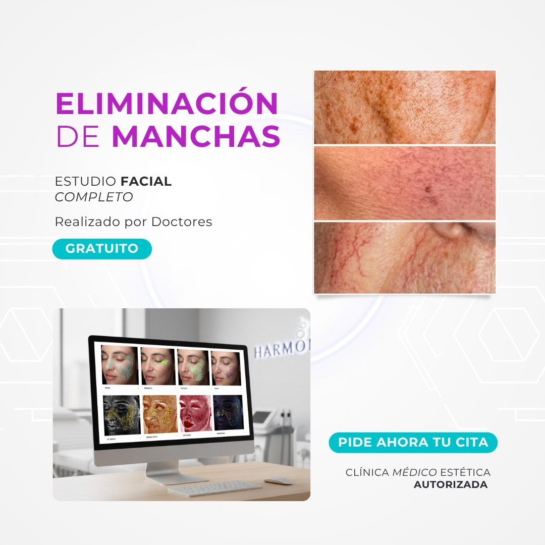 eliminacion_manchas_salamanca